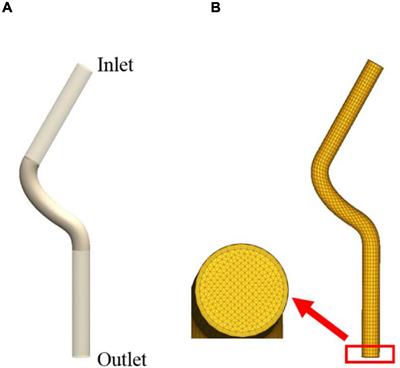 Multiscale Modeling of Vascular Remodeling Induced by Wall Shear Stress